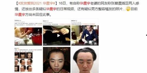 娱乐圈要谨慎吃瓜吗百度云,谨慎吃瓜，理性看待网络传闻